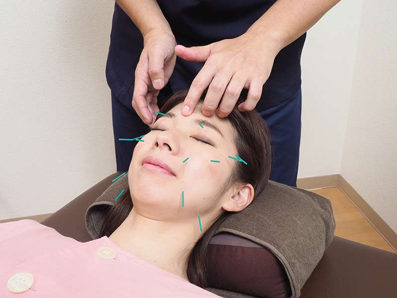 こいわ鍼灸院HARICORE